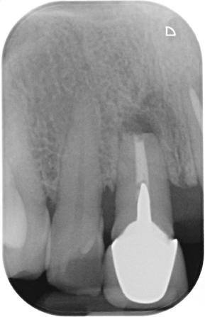 Radiografia preoperatoria