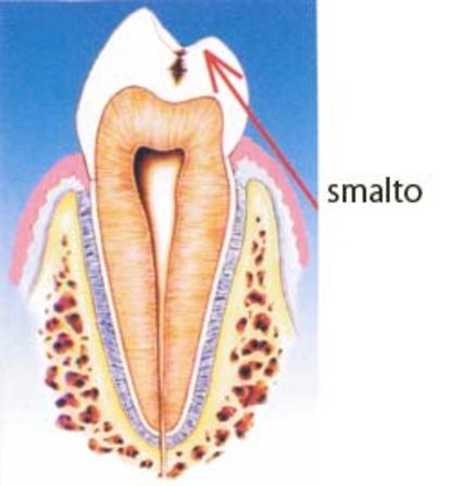 Smalto
