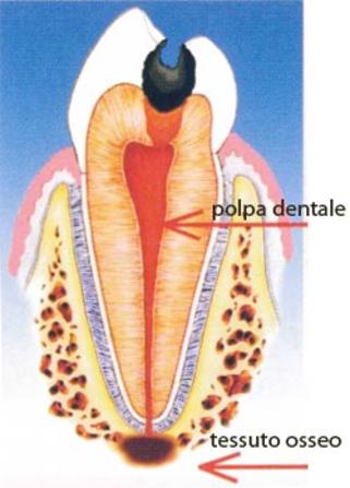Polpa dentale e tessuto osseo